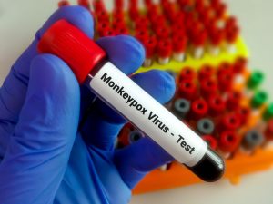 Travel and monkeypox outbreak – should we expect any restrictions?