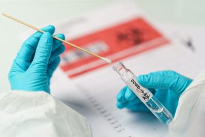 The U.S. ends Covid-19 testing requirements