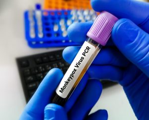 Monkeypox updates – Canada issues level-two travel notice