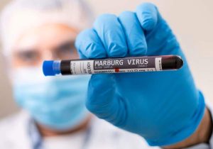 The Marburg Virus Has Claimed 10 Lives In Equatorial Guinea